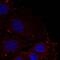 Paxillin antibody, PA5-37710, Invitrogen Antibodies, Immunofluorescence image 