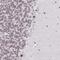 Zinc Finger Protein 382 antibody, NBP2-13569, Novus Biologicals, Immunohistochemistry paraffin image 
