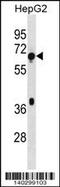 TBC1 Domain Family Member 3F antibody, 60-486, ProSci, Western Blot image 