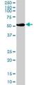 UDP Glucuronosyltransferase Family 2 Member B15 antibody, H00007366-B01P, Novus Biologicals, Western Blot image 