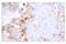 ASGP-1 antibody, 81692S, Cell Signaling Technology, Immunohistochemistry paraffin image 