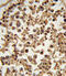 ETS Variant 6 antibody, A00361-2, Boster Biological Technology, Immunohistochemistry paraffin image 