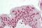 Cyclin Dependent Kinase Inhibitor 1C antibody, MBS248790, MyBioSource, Immunohistochemistry paraffin image 