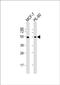 Lipoprotein Lipase antibody, PA5-71881, Invitrogen Antibodies, Western Blot image 