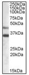 Arylsulfatase B antibody, AP08576PU-N, Origene, Western Blot image 