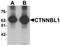 CTNNBL1 antibody, TA319966, Origene, Western Blot image 