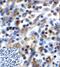 T Cell Immunoreceptor With Ig And ITIM Domains antibody, M01962, Boster Biological Technology, Immunohistochemistry paraffin image 