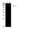 Acyl-CoA Synthetase Short Chain Family Member 1 antibody, A07972-1, Boster Biological Technology, Western Blot image 