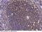 Integrin Subunit Beta 2 antibody, 102259-T10, Sino Biological, Immunohistochemistry frozen image 
