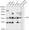 Phosphopantothenoylcysteine Synthetase antibody, 14-656, ProSci, Western Blot image 