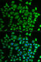 Prolyl 4-Hydroxylase, Transmembrane antibody, STJ27896, St John