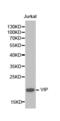Vasoactive Intestinal Peptide antibody, abx001494, Abbexa, Western Blot image 