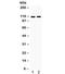 EPH Receptor A5 antibody, R32140, NSJ Bioreagents, Western Blot image 