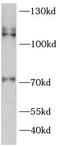 ATPase Sarcoplasmic/Endoplasmic Reticulum Ca2+ Transporting 2 antibody, FNab07732, FineTest, Western Blot image 