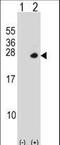 Proteasome 26S Subunit, Non-ATPase 10 antibody, LS-C162240, Lifespan Biosciences, Western Blot image 