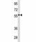 Immunoglobulin Heavy Constant Delta antibody, F40396-0.4ML, NSJ Bioreagents, Western Blot image 