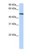 Thyroid Hormone Receptor Interactor 6 antibody, orb330636, Biorbyt, Western Blot image 