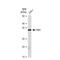 Pim-1 Proto-Oncogene, Serine/Threonine Kinase antibody, GTX00954, GeneTex, Western Blot image 