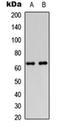 Diacylglycerol Kinase Epsilon antibody, orb256495, Biorbyt, Western Blot image 