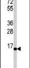 Ubiquitin Conjugating Enzyme E2 G1 antibody, PA5-11974, Invitrogen Antibodies, Western Blot image 