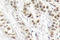 BRCA1 DNA Repair Associated antibody, LS-C177880, Lifespan Biosciences, Immunohistochemistry paraffin image 