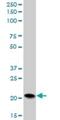 Prefoldin Subunit 5 antibody, H00005204-B03P, Novus Biologicals, Western Blot image 