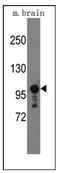 Semaphorin 5A antibody, AP12325PU-N, Origene, Western Blot image 