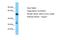 Solute Carrier Family 25 Member 30 antibody, A15327, Boster Biological Technology, Western Blot image 