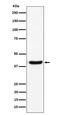 G Protein Subunit Alpha I2 antibody, M02498, Boster Biological Technology, Western Blot image 