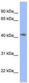 Phosphoribosyl Pyrophosphate Synthetase Associated Protein 2 antibody, TA342155, Origene, Western Blot image 