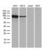 TNF Receptor Superfamily Member 8 antibody, LS-C798828, Lifespan Biosciences, Western Blot image 