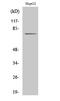 CAP-Gly Domain Containing Linker Protein Family Member 4 antibody, GTX34319, GeneTex, Western Blot image 