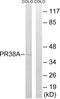 Pre-MRNA Processing Factor 38A antibody, A13639, Boster Biological Technology, Western Blot image 