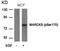 Myristoylated Alanine Rich Protein Kinase C Substrate antibody, PA5-37633, Invitrogen Antibodies, Western Blot image 