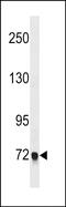 Erythrocyte Membrane Protein Band 4.1 Like 5 antibody, PA5-49177, Invitrogen Antibodies, Western Blot image 