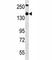 TSC Complex Subunit 1 antibody, F40321-0.4ML, NSJ Bioreagents, Western Blot image 