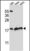 Dihydrofolate Reductase 2 antibody, PA5-48563, Invitrogen Antibodies, Western Blot image 