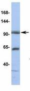 Two Pore Segment Channel 1 antibody, GTX47670, GeneTex, Western Blot image 