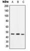 RAD52 Homolog, DNA Repair Protein antibody, MBS821320, MyBioSource, Western Blot image 