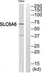 Solute Carrier Family 6 Member 6 antibody, TA314543, Origene, Western Blot image 
