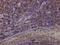 Emerin antibody, H00002010-M01, Novus Biologicals, Immunohistochemistry paraffin image 