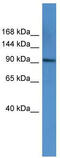 Adaptor Related Protein Complex 2 Subunit Alpha 1 antibody, TA342802, Origene, Western Blot image 