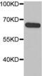 Metadherin antibody, FNab00189, FineTest, Western Blot image 