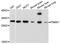Proteasome Subunit Alpha 7 antibody, A4052, ABclonal Technology, Western Blot image 