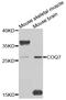 Ubiquinone biosynthesis protein COQ7 homolog antibody, STJ110079, St John