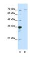 Interleukin 1 Receptor Associated Kinase 3 antibody, orb330144, Biorbyt, Western Blot image 