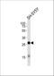 Glycoprotein M6A antibody, A06295-1, Boster Biological Technology, Western Blot image 