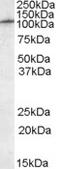 Transient receptor potential cation channel subfamily M member 5 antibody, 42-147, ProSci, Western Blot image 