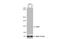 Discoidin Domain Receptor Tyrosine Kinase 2 antibody, NBP2-14926, Novus Biologicals, Western Blot image 