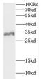 Coiled-Coil Domain Containing 28B antibody, FNab01354, FineTest, Western Blot image 